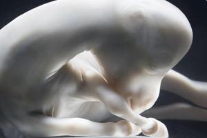 Inmunidad en el Feto y el Neonato