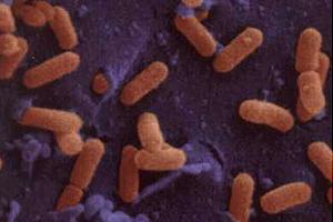 Pruebas para Listeria: Rincones que no Quiere Olvidar