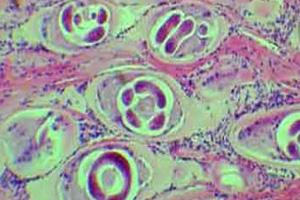 Detectan Triquinosis en Planta Municipal de Faena de Porcinos en Argentina