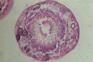 Presentaron la Primera Vacuna que Previene la Hidatidosis