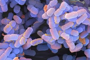 Nuevas Normas para Analizar la Presencia de E. Coli dentro de la Cadena Cárnica en EE.UU.