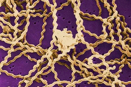 Colegio Médico Veterinario alerta sobre contagio de Leptospirosis y señala los cuidados para evitar la enfermedad 