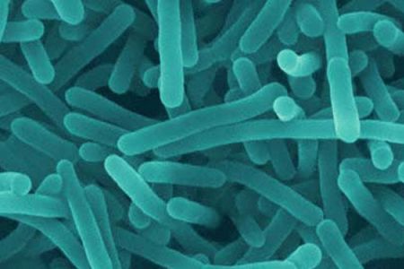Aumentan las Infecciones por Listeria entre los Mayores