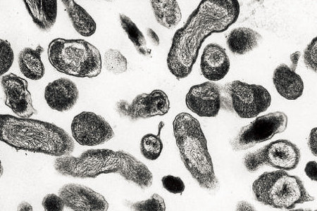 Ministerio de Salud Decreta Alerta Sanitaria en Tres Regiones por Brote Epidémico de Fiebre Q